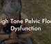 High Tone Pelvic Floor Dysfunction